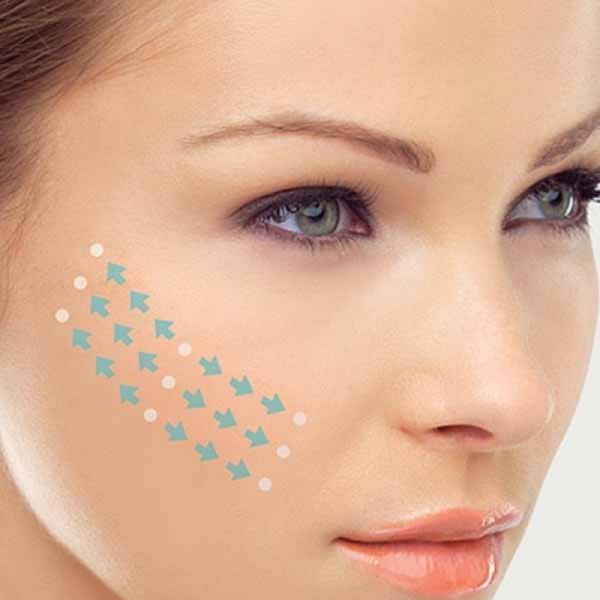 Silhouette Soft Thread Lift Menawarkan Hasil Langsung dan Jangka Panjang