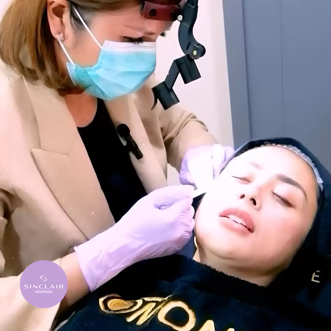 Ellansé, Solusi Lifting Instan dan Produksi Kolagen untuk Kulit Lebih Muda