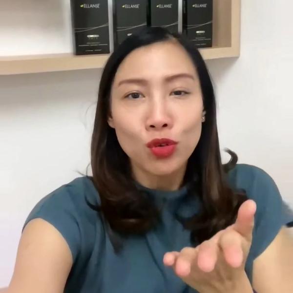 Ingin Tampil Lebih Muda? Ellanse Filler Collagen Stimulator Solusinya