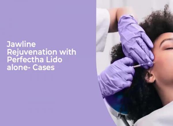 Webinar Creating the Social Media Jawline by combining HA Filler and Dynamic Cone Threads