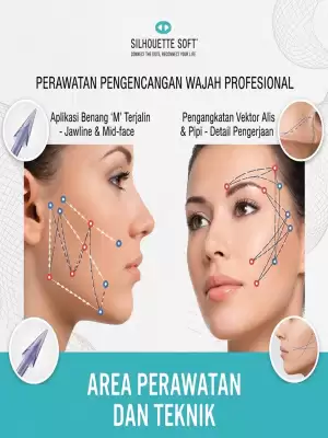 Personalisasi Thread Lift, Menentukan Teknik Benang yang Tepat Sesuai Kebutuhan Kulit