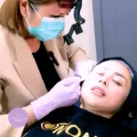 Ellansé, Solusi Lifting Instan dan Produksi Kolagen untuk Kulit Lebih Muda